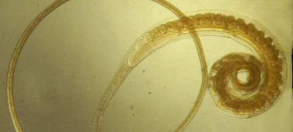 Whipworm